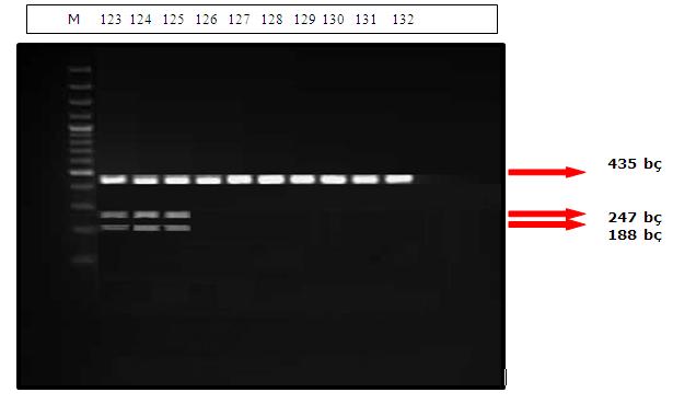 Şekil 3.9. MMP-9 geninin (-1562 C/T) bölgesinin PaeI enzimi ile kesimi sonucu 144-157,161 numaralı hastalardan elde edilen RFLP ürünlerinin jeldeki görüntüsü.