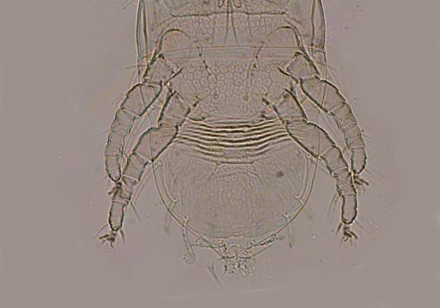 84 µm olarak belirtmiştir. Propodosoma ile hysterosoma arasındaki çizgiler oldukça belirgindir.