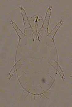 Larva Vücut uzunluğu 154,78 ±10,04, eni 88,94±1,1 ve gnathosoma ile birlikte uzunluğu 177,925 ±5,225 µm (n:2) dir.