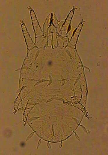 116,316± 6,33 ve gnathosoma ile birlikte boyu 226,75 ± 13,31 µm(n:5) dir.