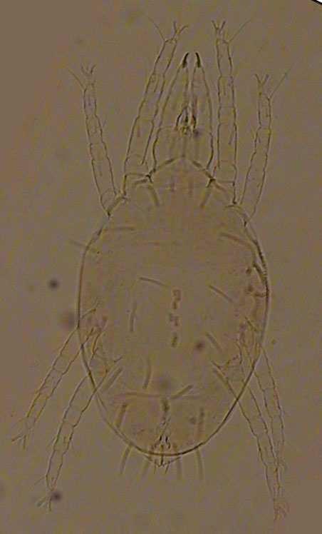4.2.2 Stigmaeidae Familyası Kozmopolit bir familya olan Stigmaeidae familyası bireyleri predatör akarlardandır. Eriophyid, tenuipalpid ve tetranychid bireyleri ile beslenmektedirler.