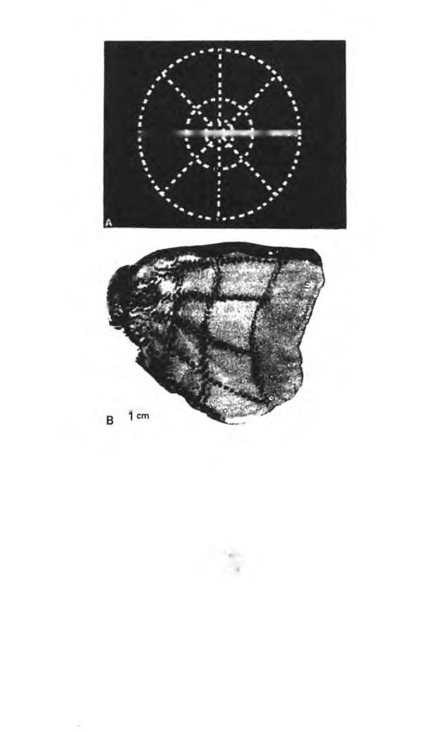 Şekil 6. Makak maymununda geometrik bir görsel uyarıcı ile beyin kabuğunun birincil görsel alanı V1 in etkinliği arasında biçim benzerliği.
