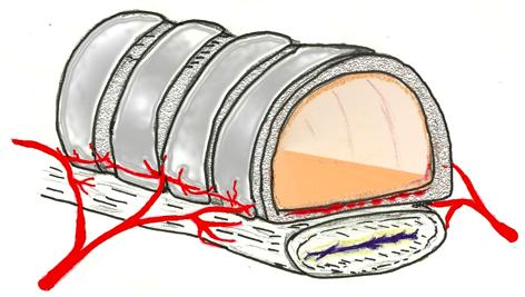 Yaşlanma ve KOAH durumlarında, antero-posterior çapın artmasına bağlı olarak lateral çap uzunluğunda azalmalar görülebilir ki buna kılıç kını (saber sheath) trakea denilir.