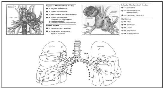 2) İnferior mediastinal lenf bezleri; subkarinal, paraözefageal ve pulmoner ligament bezlerini içeren subkarinal bölge ve inferior mediastende yerleşik bezler.