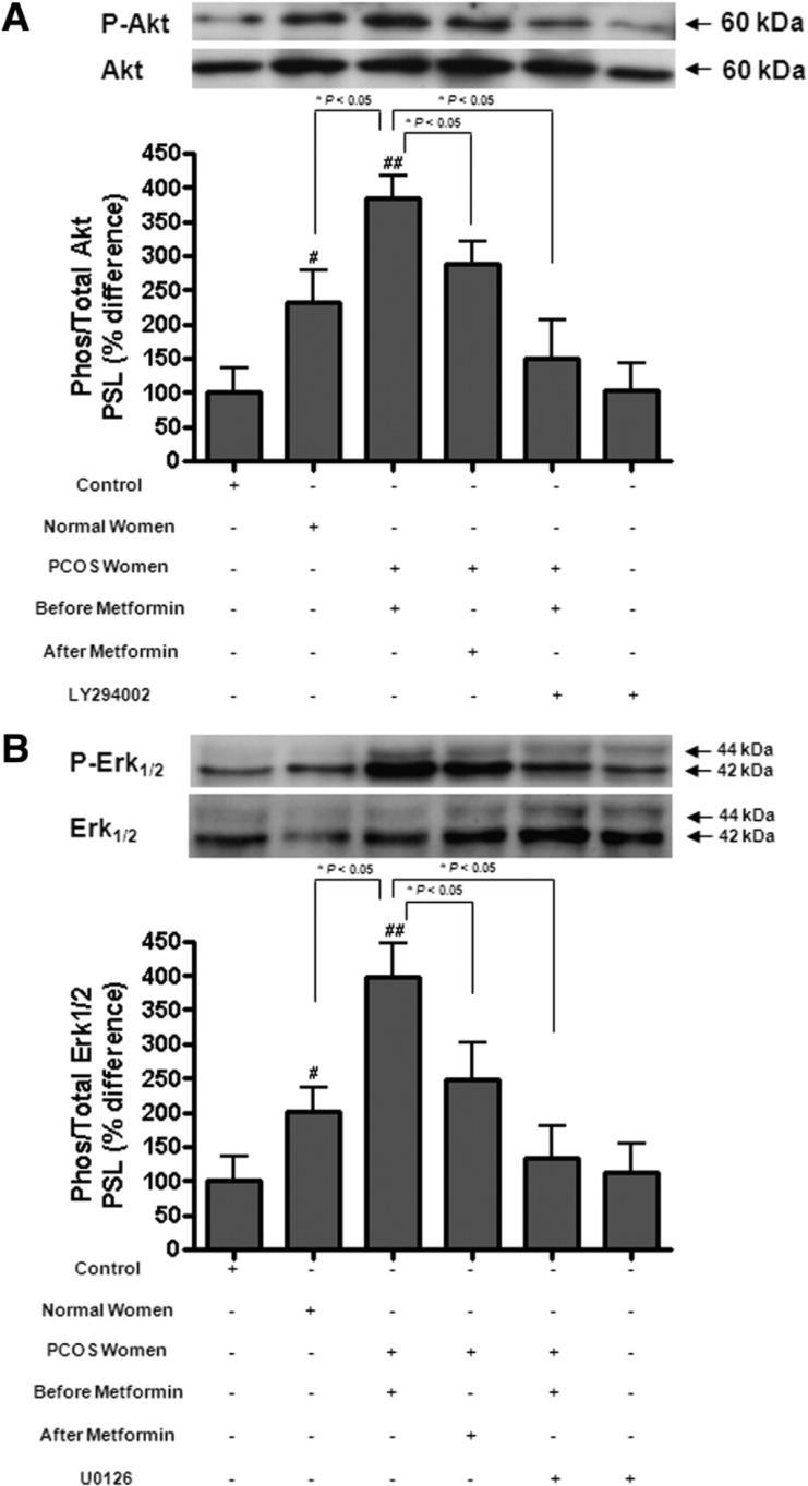 Tan BK et al, J Clin Endocrinol Metab.