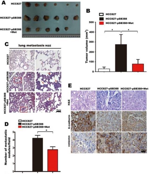 Metformin IL-6 ya bağlı akciğer adenokarsinom büyümesini, epitelden mezenkimale tranzisyonu ve