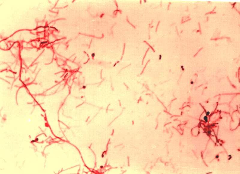 321 suşlarını kolayca öldürür. Hücre duvarında değil ama, hücre ekstraktlarında mesodiaminopimelic acid, bipolar lipitler, arylsulfatase, metylpentose bulunur, bunlar antijeniktir. C. fetus subsp.