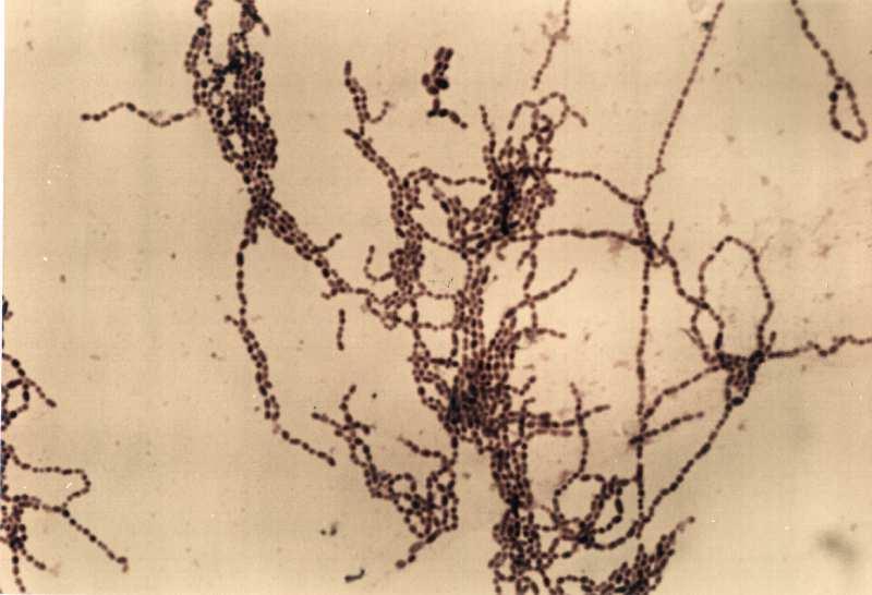 Solda Peptostreptococcus anaerobius, sağda Peptostreptococcus micros ışık mikroskobu x100 büyültmede görülmektedir. (Fotoğraflar: Murat Aydın) Abdominal, beyin, kulak ve çene P. indolicus, 0.5-0.