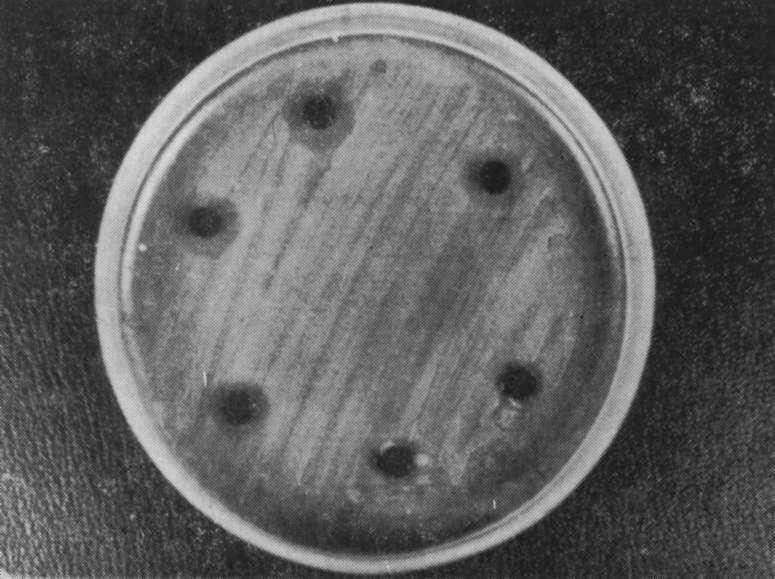 inhibisyon zonları. Resim 1b, S.