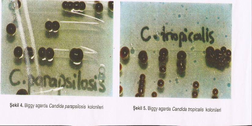 Kandidalar, Biggy Agar da kahverenginden siyaha giden pigmentli ve çevresi siyah çöküntülü koloniler yaparlar. Bu besiyerinde özellikle C. albicans, C. tropicalis, C. krusei ve C.