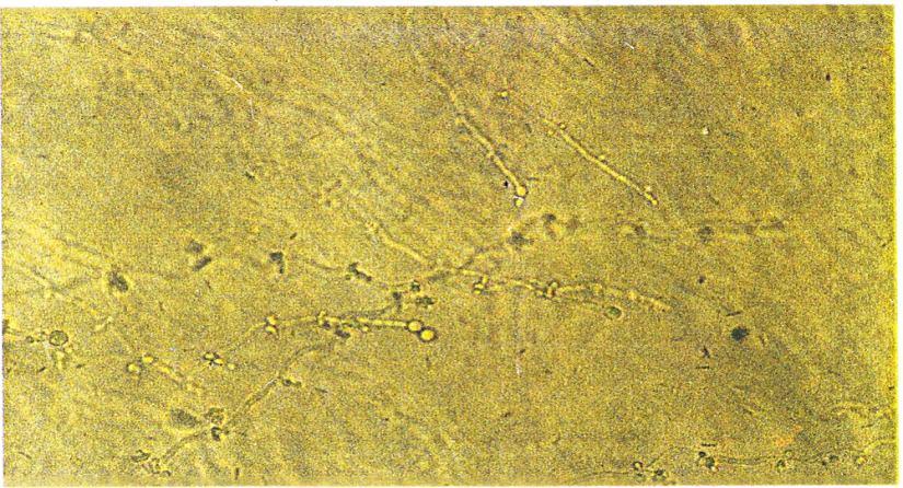 3.4. Klamidosporların incelenmesi Klamidospor, dinlenme sporudur. Bu yapı C.albicans için belirginken, C.dubliniensis te klamidospor oluşturabilmektedir. C.stellatoidea da ise çok seyrek gözlenebilmektedir.