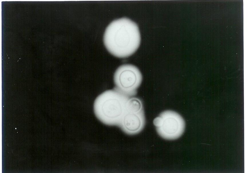 Kapsül antijeninin aranması Cryptococcus neoformans Cryptococcus albidus Çapı 3,5-8µm yuvarlak oval maya hücreleri;