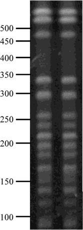 In Vivo Emergence of Colistin Resistance in Klebsiella pneumoniae Producing KPC-Type Carbapenemases Mediated by Insertional Inactivation of the PhoQ/PhoP mgrb Regulator mgrb PhoQ/PhoP ekspresyon