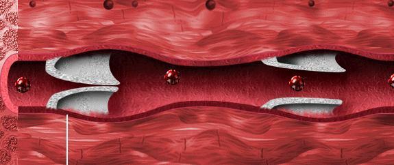 Venler Dokulardan kirlenmiş kanı toplayarak kalbe getiren damarlardır. Akciğer toplardamarı (vena pulmonalisler) hariç diğer venler kirli kan taşır.