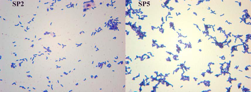 mikroskobik morfolojileri Resim 4.7. P.