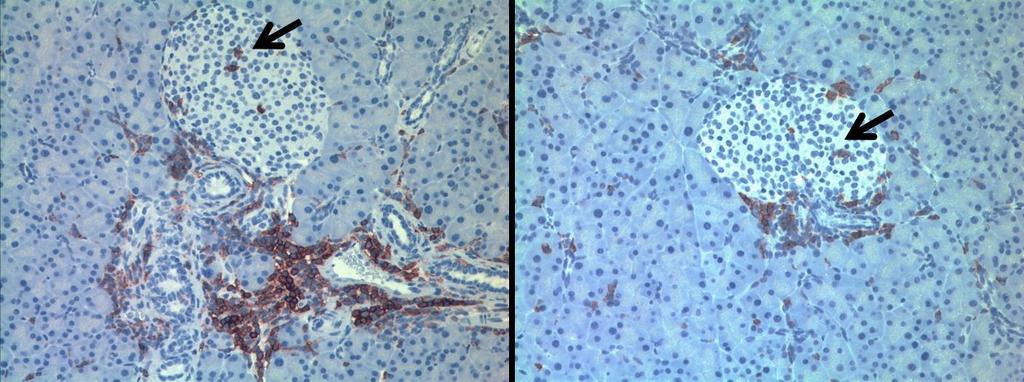 8 hafta sonra fare pankreasları çıkartılarak H&E, insan CD45 ve insülin ile boyandı ve histopatolojik analizi yapıldı (a).