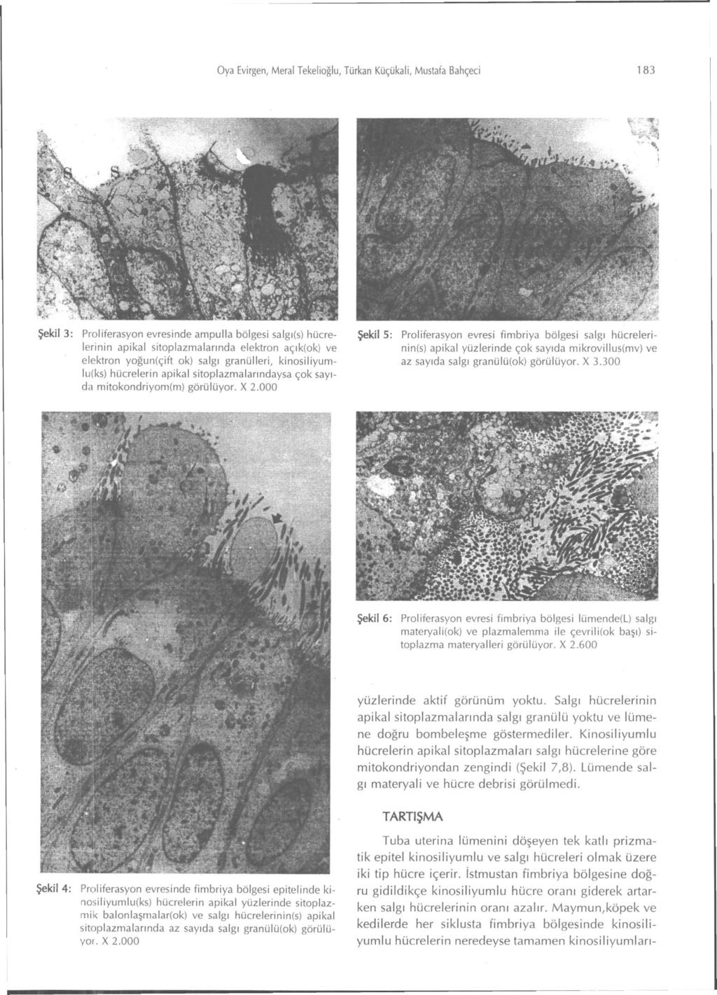 Oya Evirgen, Meral Tekelioğlu, Türkan Küçükali, Mustafa Bahçeci 183 Şekil 3: Proliferasyon evresinde ampulla bölgesi salgı(s) hücrelerinin apikal sitoplazmalarında elektron açık(ok) ve elektron