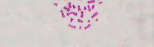 Kromozom kırığı (B'') bulunan