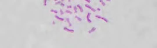 Kromozom Yapı ve Sayı Anormalliklerinin Saptanması KA ni belirlemek için her bir kişiden hazırlanan preparatlardan iyi dağılmış kromozomlara sahip toplam 100 hücre (altı kişiden toplam 600)