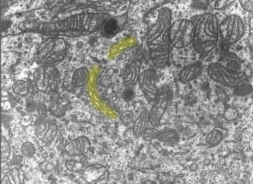 Golgi Kompleksi Mitokondri Bir hücrenin