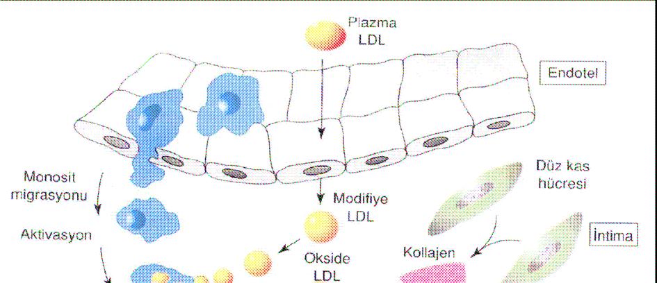 Şekil 5. Ateroskleroz gelişim şemasõ Şekil 5. Ateroskleroz gelişimi.