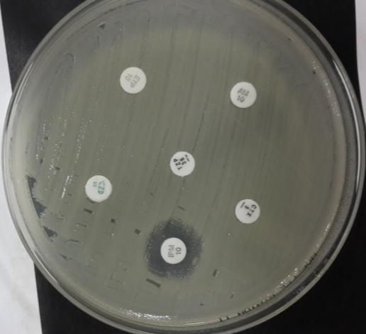 Antibiyotik Zon Çapı (mm) Ampicillin (10) 6 Cefotaxime (5) 6