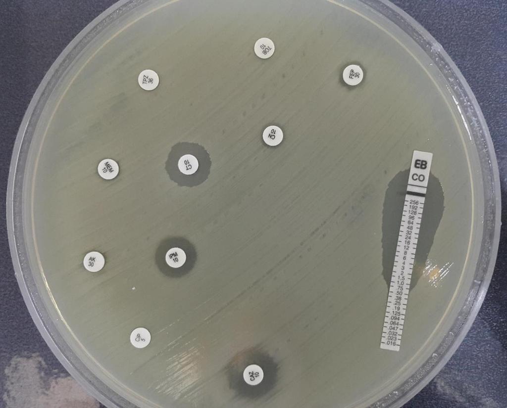 Kolistin MİK= 0.75 mg/l Rapor: Karbapenemaz üreten suştur.