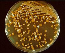 Ayrıca Cryptococcus neoformans kuşkusu nedeniyle etkene üre testi yapılır. Bu test beşinci saatte zayıf pozitif, 24 saatte tam pozitif olarak izlenir. 48.