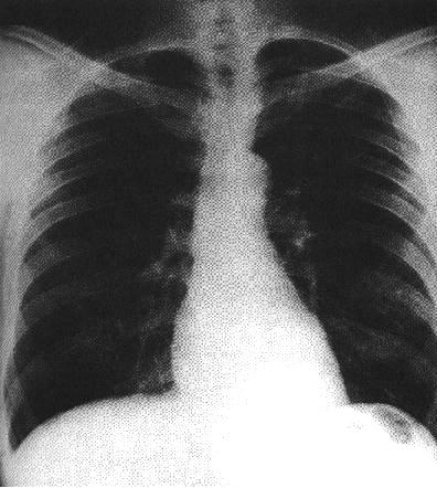 (a b) + (c d) = 13; 14 cm. L = 15; 16 cm. I- Aorta I- V.