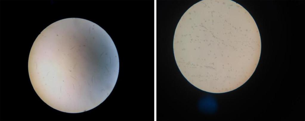 a Şekil 7(a) Deney öncesi protozoa kültürü, () Deney gruu-3 protozoa kültürü Deney gruu-4 olarak isimlendirilen ıslak mendilden alınmış örnekler arasından seçilen görüntü örneği, şekil 8 de
