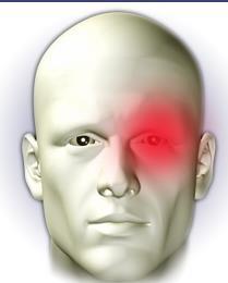 Küme baş ağrısı A. Hemen hemen daima tek taraflı, B. Çoğunlukla frontal-periorbital bölgeye lokalize, C.