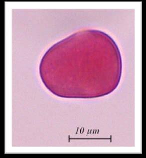 4.BÖLÜM BULGULAR Echium L. türlerinin polen morfolojilerine göre düzenlenmiş anahtarı 1. Polen şekli Oblate-Spheroidal..... 4. parviflorum 1. Polen şekli Subprolate 2. Ekvatoral eksen 13-13,50 µm 3.
