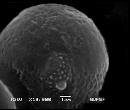 ekvatoral eksen ortalama 12,5 µm (11-12 µm) tır.