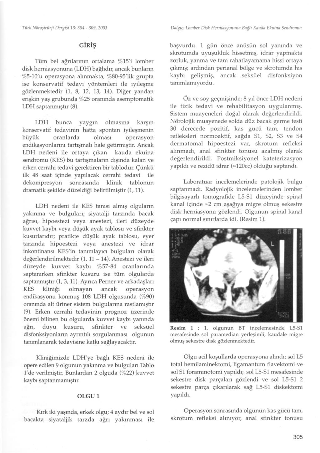 Tiirk Nörosiriirji Dergisi 13: 304-309, 2003 Dalgiç: Lomber Disk Hemiasyonuna Bagli Kauda Ekuiiia Sendromu: GIRIs Tüm bel agrilarinin ortalama %is' i lomber disk herniasyonuna (LDH) baglidir, ancak