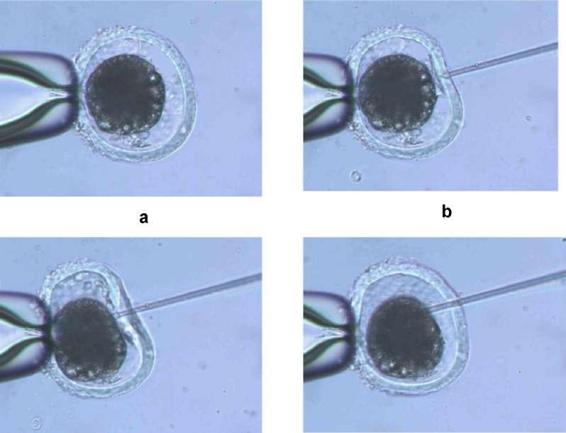 44 İçinde oosit ve spermatozoonların bulunduğu petri alınarak manipülatörün ayarları bozulmadan mikroskoba yerleştirildi.