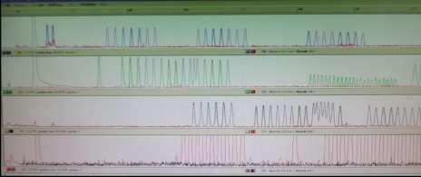 Amelogenin gen bölgesi Şekil-7 Erkek bir bireye ait kapiller kolonlu genetik analiz cihazındaki görüntü Amelogenin gen bölgesi 510 Şekil-8 Dişi bir bireye ait kapiller kolonlu genetik analiz