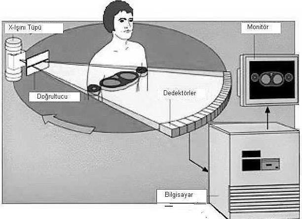 Şekil 1.15 Bilgisayarın BT görüntüleme sistemindeki yeri BT sistemini oluşturan iki diğer ünite ise görüntüleme ünitesi ve kameradır. Birçok BT sisteminde çoklu-format kamera kullanmaktadır.