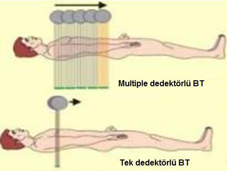 MDBT teknolojisinin esasını dedektör yapısı oluşturmaktadır. Konvansiyonel spiral BT yani tek dedektörlü BT cihazlarında dedektör elemanları tek bir sıra halinde dizilmiştir.