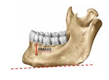 mentale nin orta noktası ile arcus alveolaris (corpus mandibulae nın üst kenarı) arasındaki uzaklık (referans