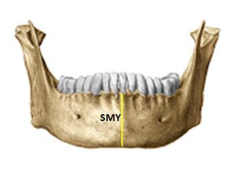 (Resim 2.10 A), (Resim 2.10 B). A B Resim 2.10. Symphysis mandibulae yüksekliği.