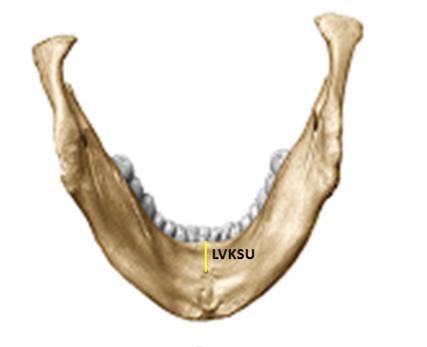 Lingual vasküler kanalın corpus mandibulae alt kenarına uzaklığı (LVKIU); her bir lingual