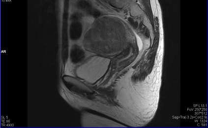 Materyal-Metod Resim 3.