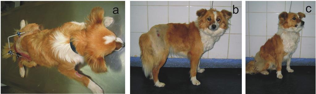 Clinical views of before (a) and after removal external skeletal fixator of Case no: 1 (b, c).