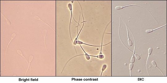 10 Resim 2. Farklı filtrelerdeki spermatozoonların görünümü.