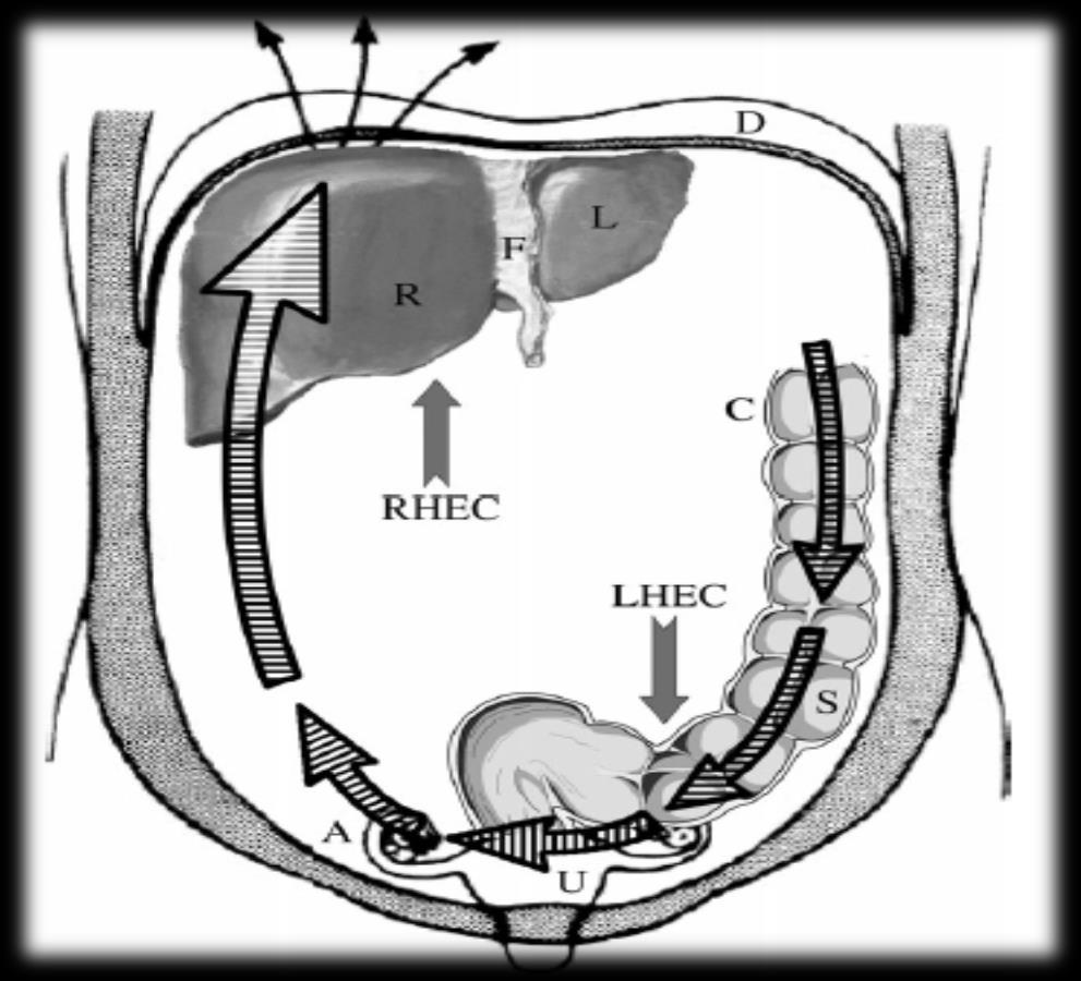 ANATOMİK DAĞILIM ÇALIŞMALARI KC Sol lob Diafram Sol ovarian endometrioma % 63 KC Sağ lob Lig.