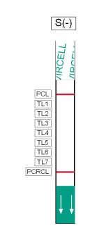 Bundan başka, Mikobakteri cinsi (TL7) nin amplifikasyonu PCR kontrol (PCRCL) den daha verimlidir.