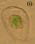 Spirogyra