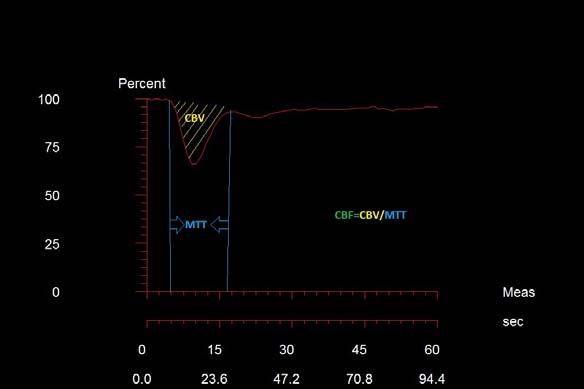 düzeyinden bir miktar daha aşağıda izlenir. Bunun nedeni dolaşımda dağılan ve sirkülasyon ile dokuda perfüze olmaya devam eden kontrastın minimal T2 etkisidir (104). Şekil 7.