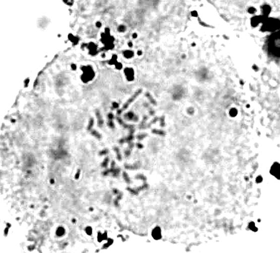 kromozom görüntüsü 2 µ