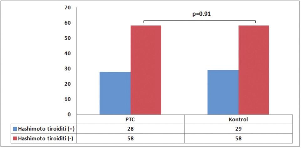 S. Erdoğmuş et al., Relationship between papillary thyroid cancer and Hashimoto s disease lobda, 18 inde (%20,7) yalnızca sol lobda, 43 ünde (%49,4) ise bilateral yerleşimliydi.